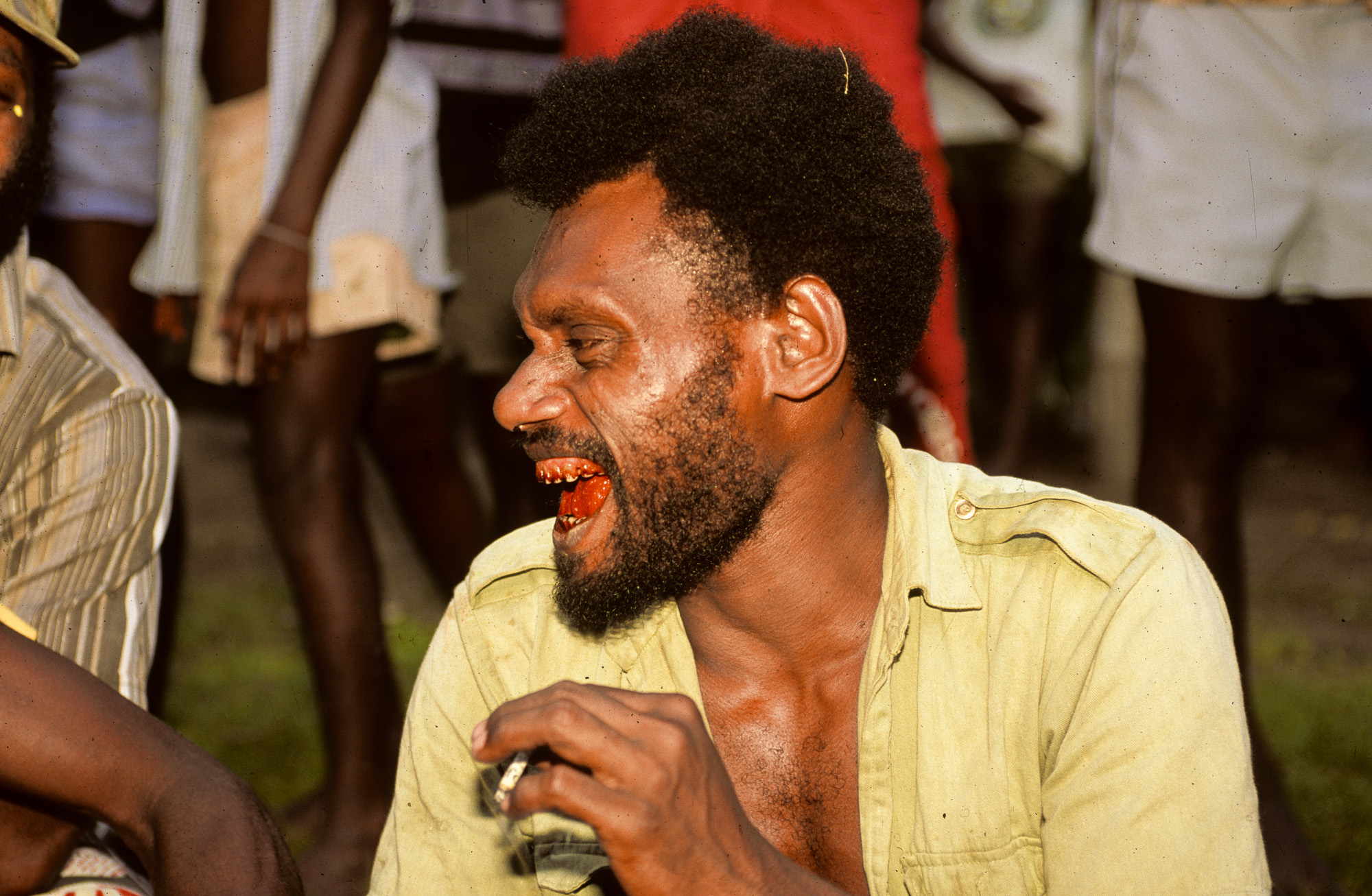 Nouvelle Guinée Papouasie. Rabaul, tribu des Tolaï. Cet habitant a les lèvres en sang car il mache du bétel additionné de chaux vive.