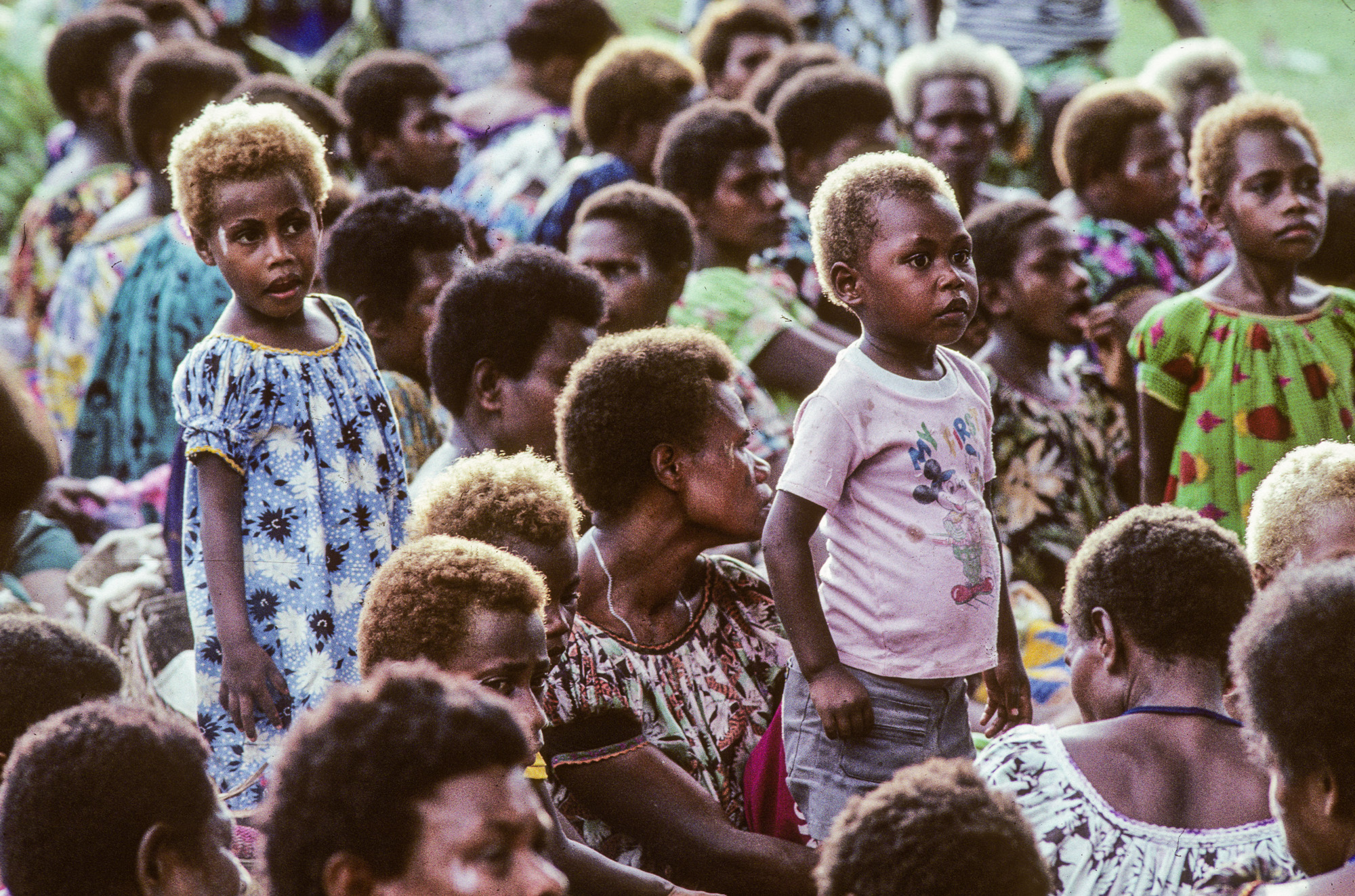 Nouvelle Guinée Papouasie. Rabaul, tribu des Tolaï. Beaucoup d'habitants sont blonds, à cause de la malnutrition qui sévit dans ses contrées perdues.